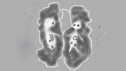 film still: Scary skeleton foetuses – you really can see their skulls and inside their bodies during the scans. Multiple pregnancies have to have lots of scans as the normal blood tests done on singletons don’t work.

